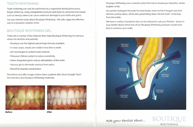 Teeth Whitening